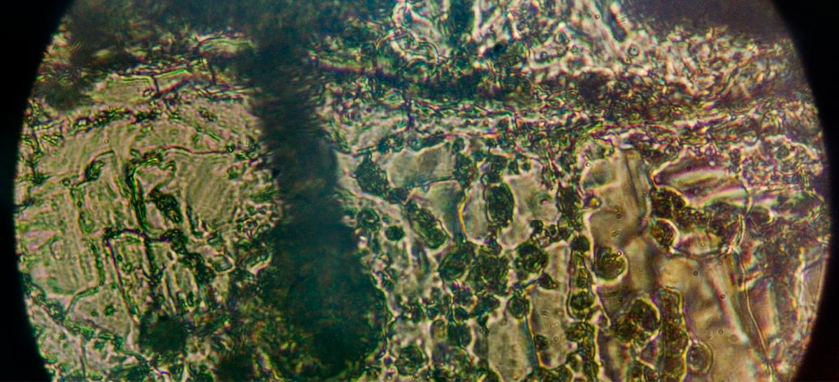 A circular microscope view showing a highly detailed, textured green and brown cellular structure or biological specimen under magnification.